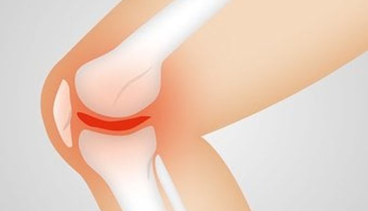 Knee Replacement Surgery