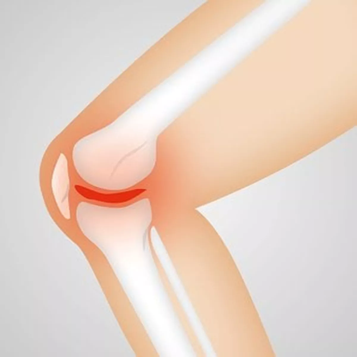 Knee Replacement Surgery – Why it’s getting so big From Someone Who Has Been There